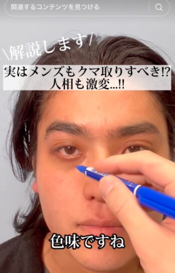 eクリニック福岡院 TikTok動画(男性向けのクマ取り)
